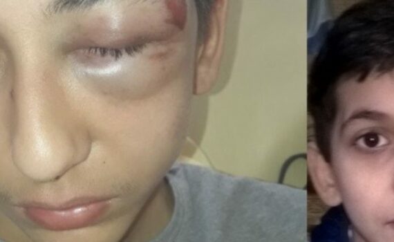 Mourir En Garde À Vue ?